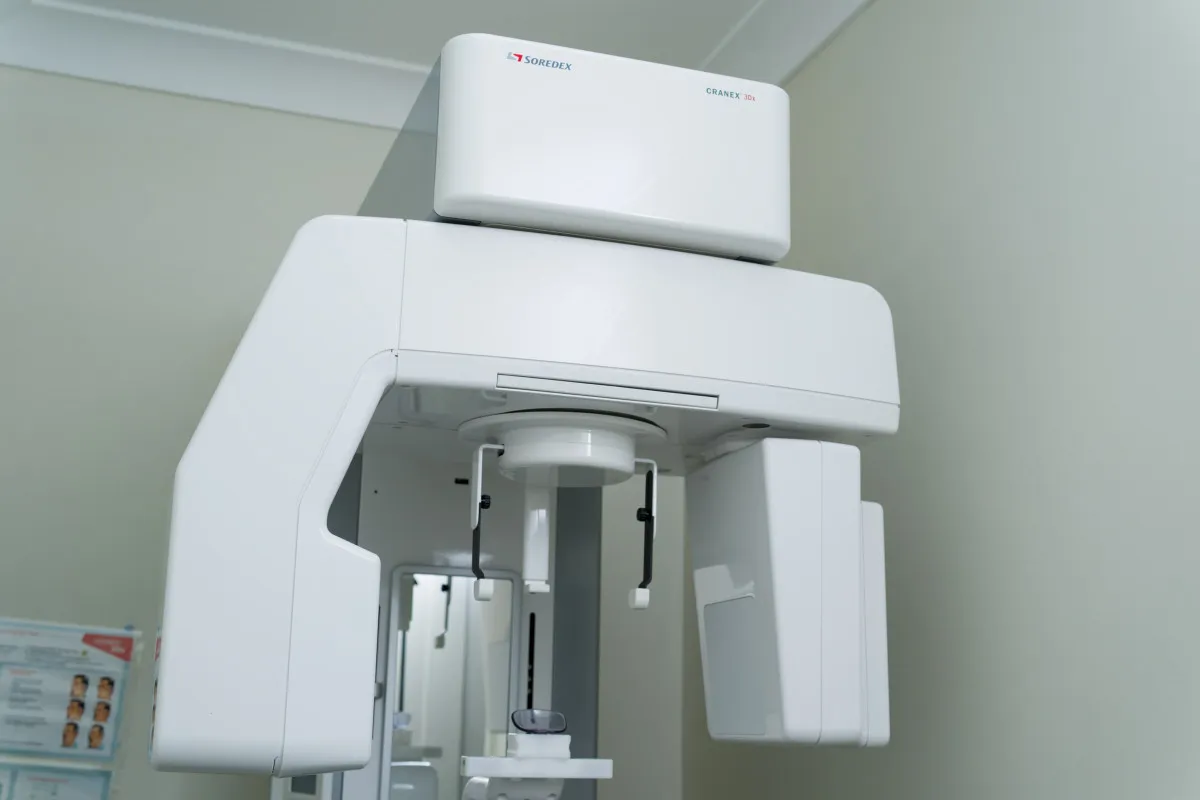 3D CBCT scan used to plan implant position