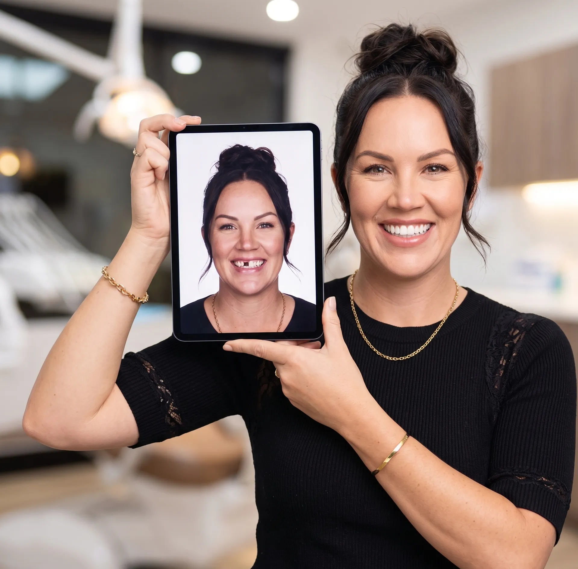 Before and after dental implant treatment case example